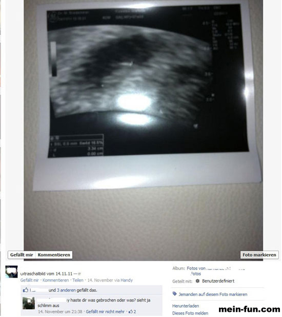 facebook fail baby