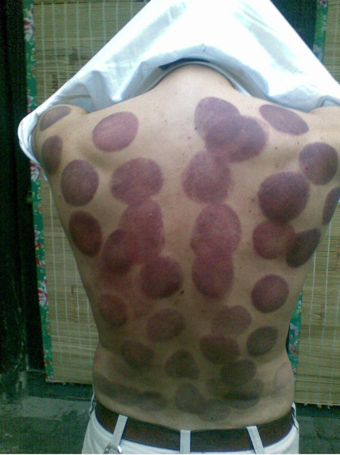 Chinesische Massage ist entspannend