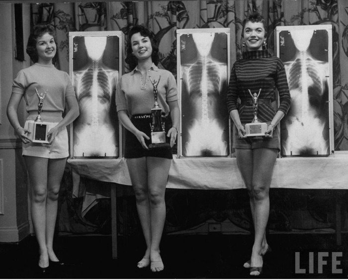 Chiropractor Beauty Contest