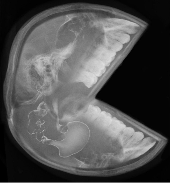 Pacman X RAY