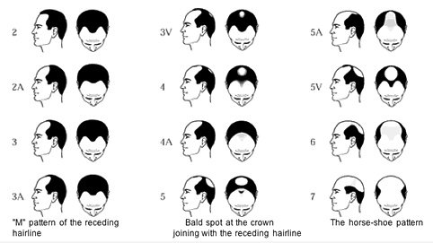 Haar Pattern