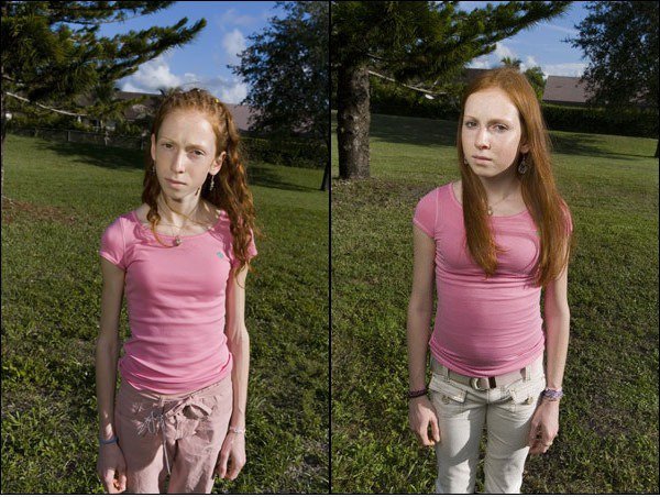 Wahrheit girls: dünne ≠ pretty
