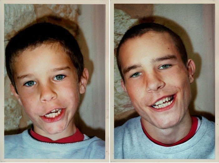 1990 vs 2010