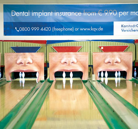 dental implant