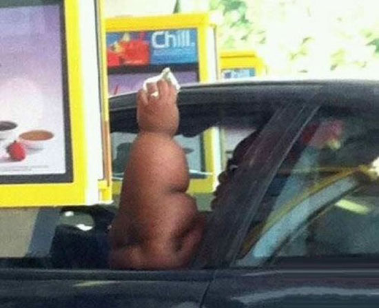 extrem fette hand