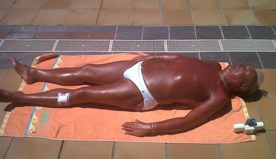 sonnenbaden extrem