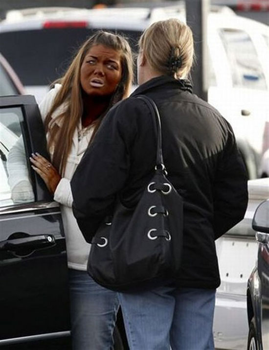 tanning gone wrong