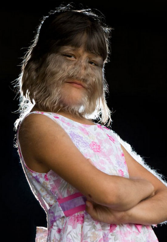 worldrsquos hairiest girl
